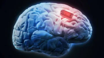 Bu il 20-30 nəfərə “Neuralink”in beyin implantı yerləşdiriləcək